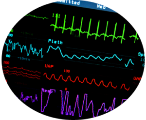 ecg monitor