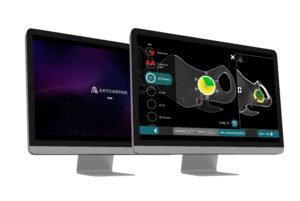 Artiosense sensing device monitor