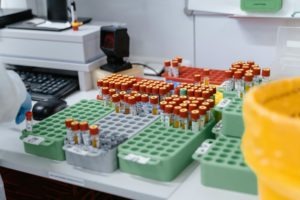 Gene Therapy and ophthalmic drug delivery